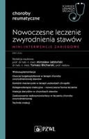 Nowoczesne leczenie zwyrodnienia stawów Jabłoński