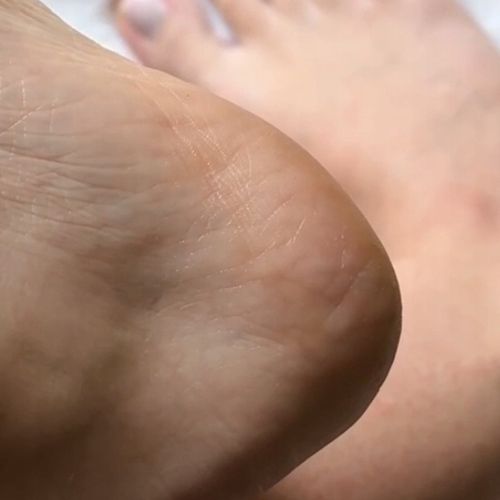 GLOV Pumeks tarka do stóp z nano szkła różowa – usuwa zrogowaciały naskórek na Arena.pl