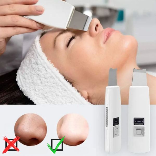 peeling kawitacyjny do twarzy bezprzewodowy zdjęcie 2