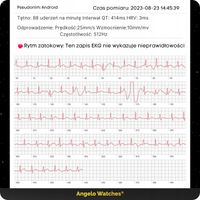 Smartwatch Angelo Watches AT300 srebrny