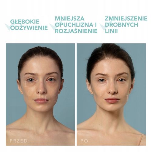 Głęboki nawilżacz do twarzy UFO 3, Arctic Blue na Arena.pl