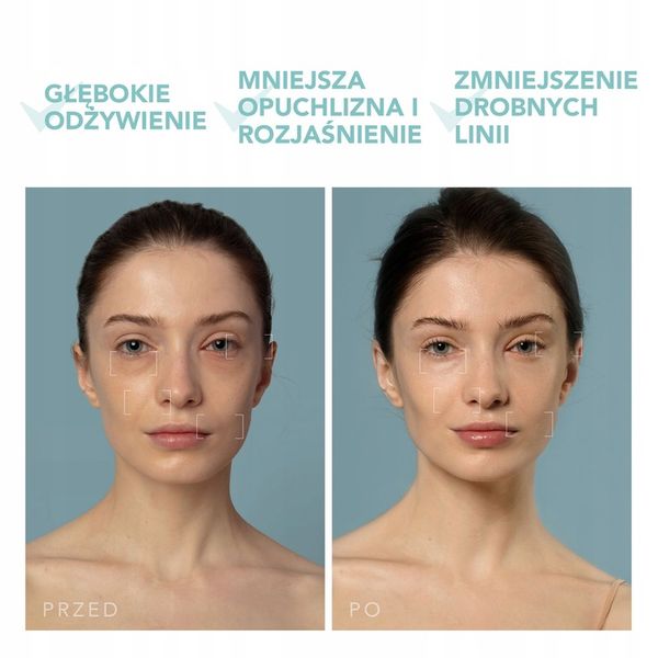 Głęboki nawilżacz do twarzy UFO 3, Arctic Blue zdjęcie 5