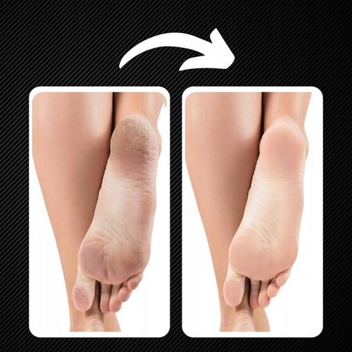 PILNIK DO STÓP MEGA ZESTAW DO PIĘT PILNICZEK ELEKTRYCZNY LED + NASADKI 15w1 na Arena.pl