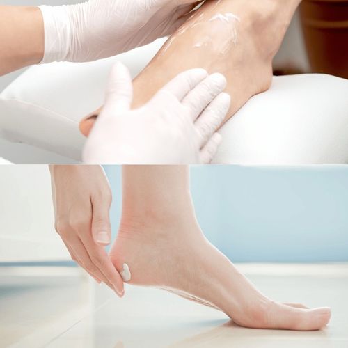 Krem do Stóp z Mocznikiem SILNY Krem do Pięt SUCHA ZROGOWACIAŁA SKÓRA 2x na Arena.pl