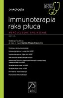 Immunoterapia raka płuca Kamila Wojas-Krawczyk