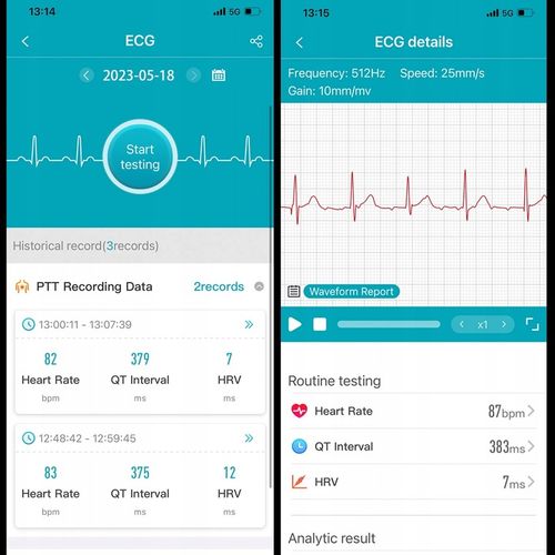 SMARTWATCH ZEGAREK MĘSKI GLUKOZA POMIAR CUKRU EKG CIŚNIENIE MENU POLSKIE na Arena.pl