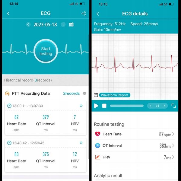 SMARTWATCH ZEGAREK MĘSKI GLUKOZA POMIAR CUKRU EKG CIŚNIENIE MENU POLSKIE zdjęcie 5