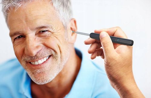 SMART OTOSKOP KAMERA CZYSZCZENIE USZU WOSK WIFI HD APLIKACJA ENDOSKOP na Arena.pl