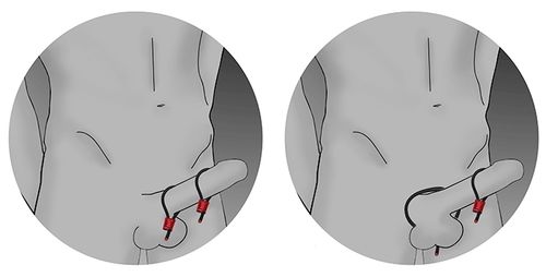 prestige electraloops 2 x regulowany cockring (srebrny) electrastim na Arena.pl