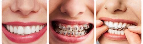 Irygator dentystyczny OCLEAN Airpump A10 Biały na Arena.pl