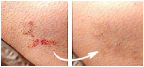 Blue CAP Krem Skóra Egzema Łuszczyca Łojotok Atopowe Zapalenie 50g na Arena.pl