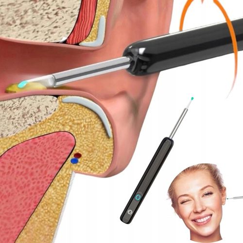 SMART OTOSKOP KAMERA CZYSZCZENIE USZU WOSK WIFI HD APLIKACJA ENDOSKOP na Arena.pl