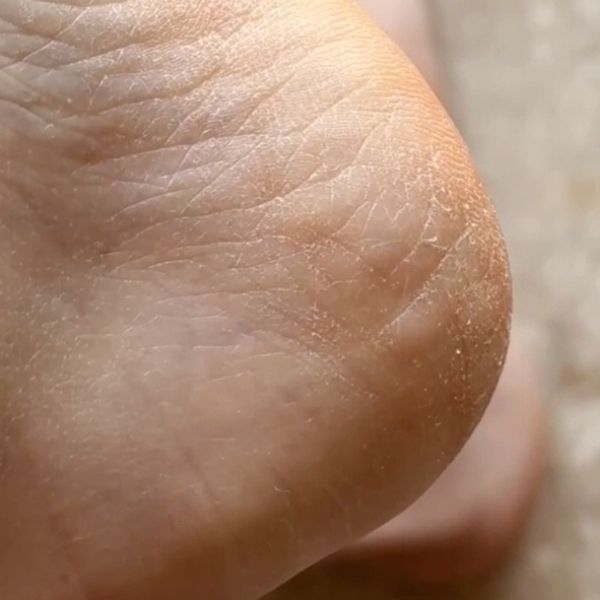 GLOV Pumeks tarka do stóp z nano szkła różowa – usuwa zrogowaciały naskórek zdjęcie 14