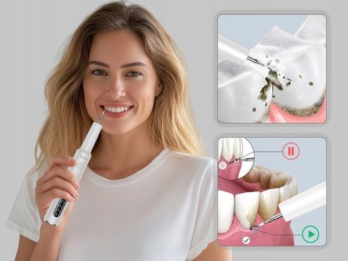 Skaler Ultradźwiękowy Dentystyczny Do Zębów - 4 tryby do usuwania na Arena.pl