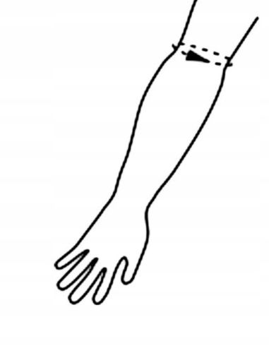 STABILIZATOR ŁOKCIA ORTEZA STAWU ŁOKCIOWEGO OPASKA UCISKOWA NA RĘKĘ na Arena.pl