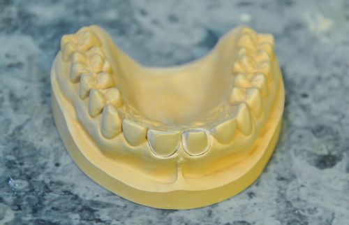 Silikon platinum dla techników dentystycznych 6 kg na Arena.pl