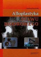 ALLOPLASTYKA STAWU BIODROWEGO ANDRZEJ POZOWSKI