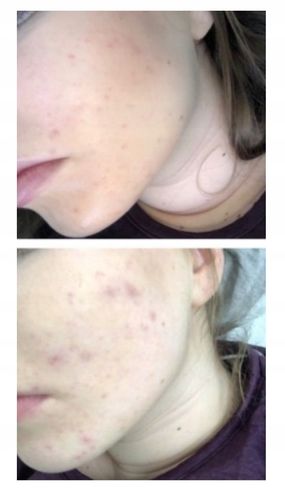 The Ordinary Tonik do Twarzy Glycolic Acid 7% Peeling Glikolowy 240 ml na Arena.pl