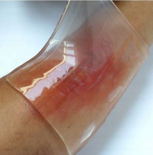 OPATRUNEK HYDROŻELOWY na oparzenia RATUNKOWY Kikgel BurnTec 12cmx12 cm 1szt zdjęcie 4