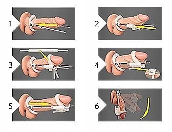 Rozciągacz Penisa PUMPED Penis Extender Czarny na Arena.pl