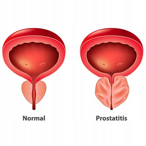PROTON LABS Prostanol Forte - palma sabałowa na prostatę na Arena.pl
