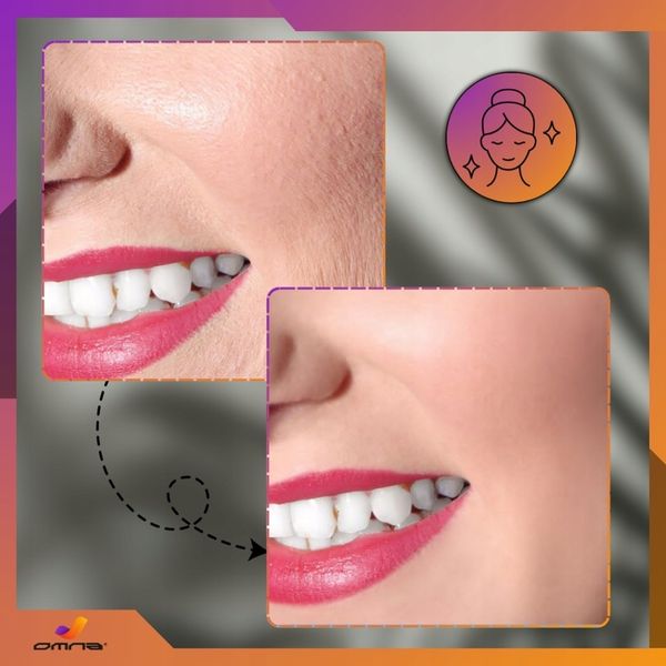 Urządzenie darsonval derma wand pro najmocniejszy LZ006A 4 elektrody peloty zdjęcie 9