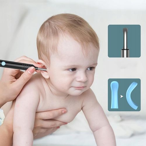 SMART OTOSKOP Z KAMERKĄ WIFI DO CZYSZCZENIA USZU NARZĘDZIA ZESTAW ENDOSKOP na Arena.pl