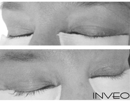 Odżywka do rzęs, serum do rzęs przyśpieszające wzrost long lashes z INVEO na Arena.pl