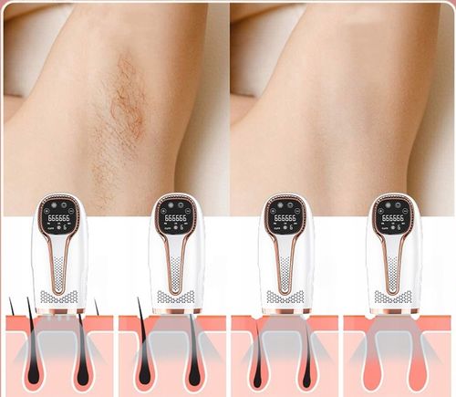 DEPILATOR LASEROWY IPL DO WŁOSÓW CIAŁA BIKINI NÓG DEPILACJA BEZBOLESNY na Arena.pl