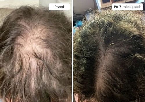 Wcierka Serum na porost i wypadanie włosów wzmacnia cebulki - Lavress 10w1 na Arena.pl