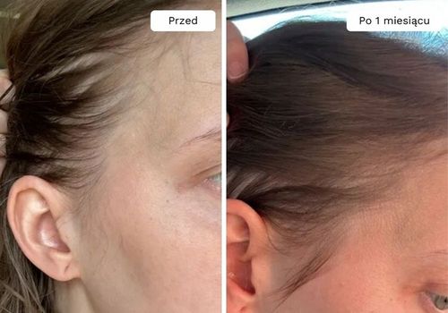 Wcierka Serum na porost i wypadanie włosów wzmacnia cebulki - Lavress 10w1 na Arena.pl