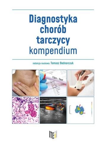 Diagnostyka chorób tarczycy - kompendium na Arena.pl