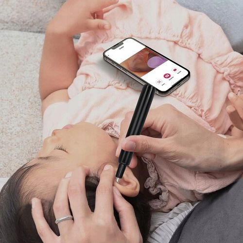 Smart Otoskop Kamera Czyszczenie Uszu Do Usuwania Woskowiny Wosk Wifi na Arena.pl