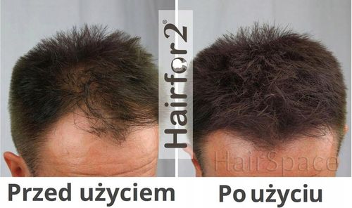HairFor2 100ml Mikrowłókna w Sprayu do Zagęszczania Włosów na Arena.pl