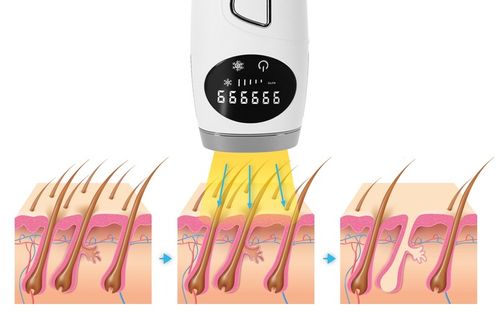 Depilator IPL Krexus Pro ICE COOL Ciało Bikini na Arena.pl