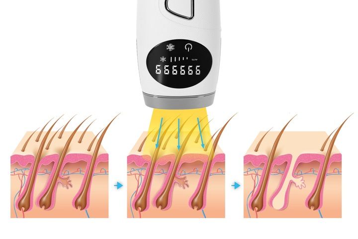 Depilator IPL Krexus Pro ICE COOL Ciało Bikini zdjęcie 10