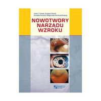 NOWOTWORY NARZĄDU WZROKU JACEK..