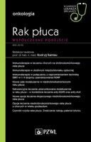 Rak płuca Współczesne podejście Rodryg Ramlau