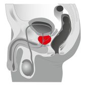 plug/prostata-joystick prostata booster, black