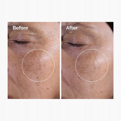 Ordinary Glycolic Acid 7% Toning Solution Tonik Peeling Glikolowy na Arena.pl