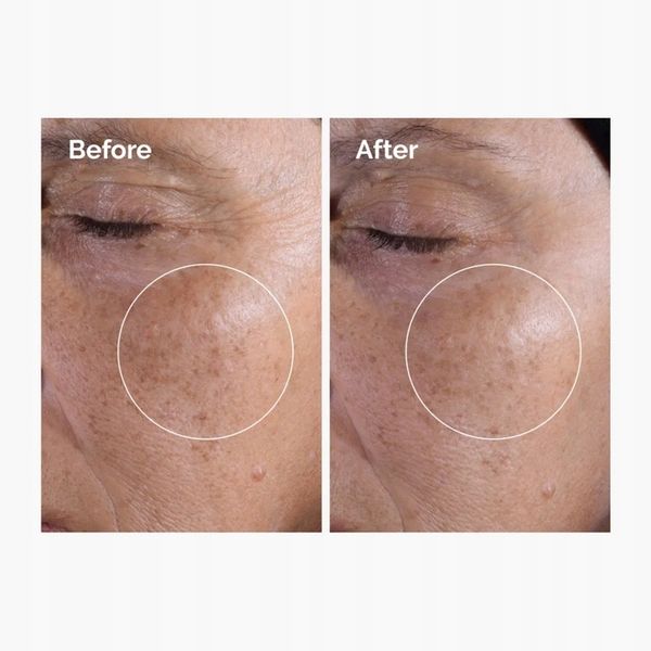Ordinary Glycolic Acid 7% Toning Solution Tonik Peeling Glikolowy zdjęcie 6