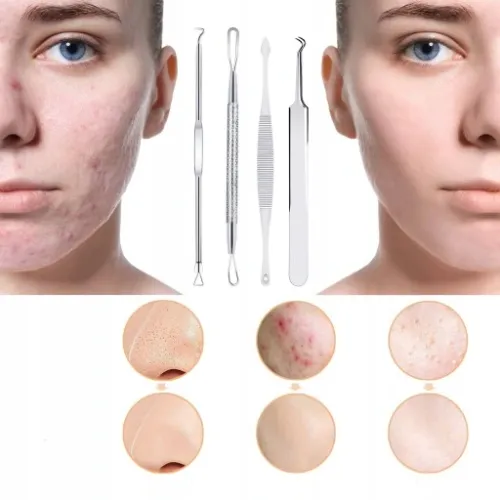 LYZECZKI ŁYŻECZKI UNY DO USUWANIA WĄGRÓW ZASKÓRNIKÓW WĄGRY USUWANIE 8 SZT na Arena.pl