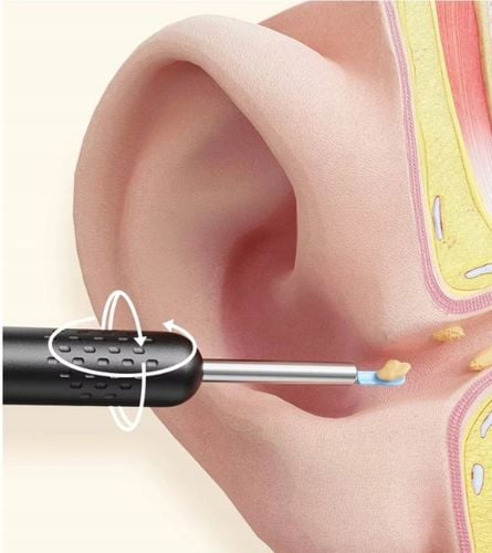 ZESTAW DO USUWANIA WOSKOWINY Z KAMERĄ 8 MEGAPIXELI HD 6 LED ENDOSKOP na Arena.pl