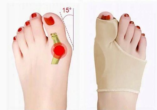 OPASKA NA HALUKSY Z ŻELOWYM KLINEM x 2 na Arena.pl