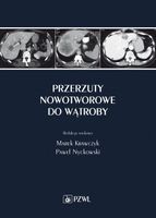 PRZERZUTY NOWOTWOROWE DO WĄTROBY MAREK KRAWCZYK