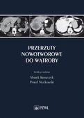 PRZERZUTY NOWOTWOROWE DO WĄTROBY MAREK KRAWCZYK