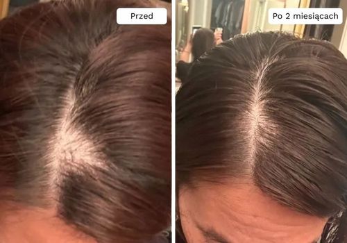 Wcierka Serum na porost i wypadanie włosów wzmacnia cebulki - Lavress 10w1 na Arena.pl