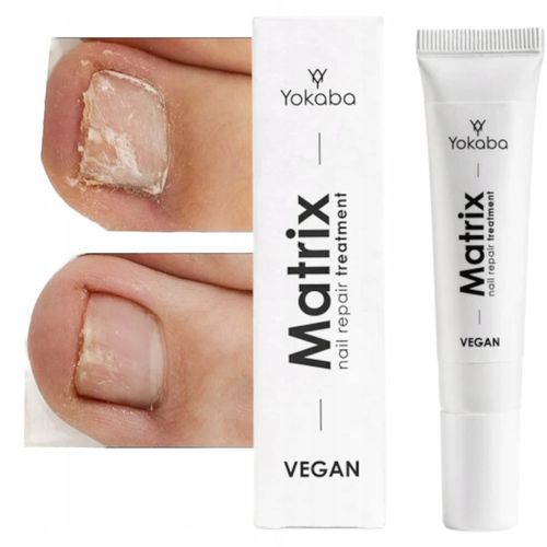 Yokaba MATRIX Preparat do regeneracji macierzy paznokcia 15 ml na Arena.pl