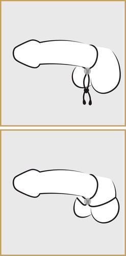 pierścień wzmacniający erekcję zacisk na penisa na Arena.pl