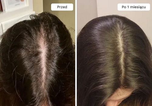 Wcierka Serum na porost i wypadanie włosów wzmacnia cebulki - Lavress 10w1 na Arena.pl